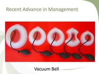 Recent Advance in Management
Vacuum Bell
 