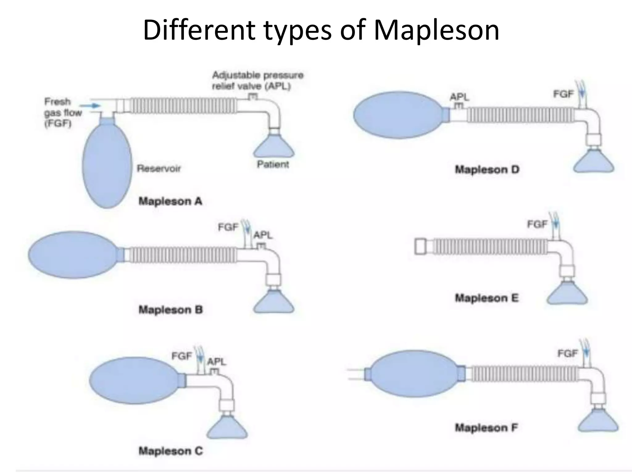 Different types of Mapleson
 