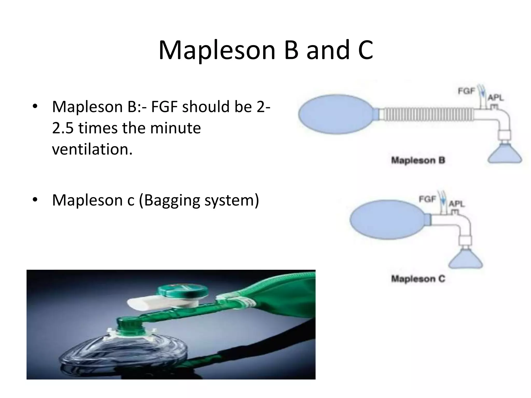 Mapleson B and C
• Mapleson B:- FGF should be 2-
2.5 times the minute
ventilation.
• Mapleson c (Bagging system)
 