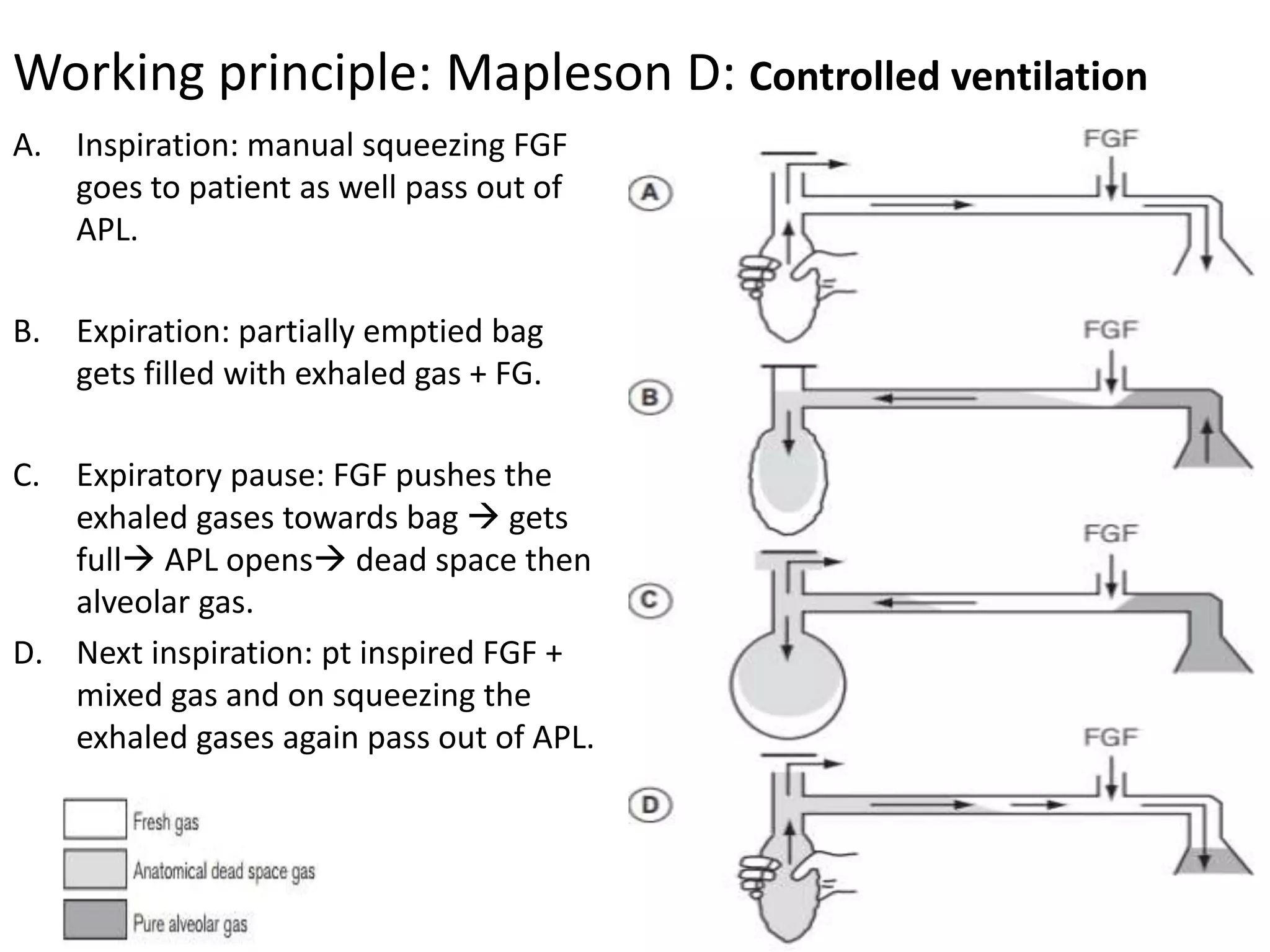 A. Inspiration: manual squeezing FGF
goes to patient as well pass out of
APL.
B. Expiration: partially emptied bag
gets filled with exhaled gas + FG.
C. Expiratory pause: FGF pushes the
exhaled gases towards bag  gets
full APL opens dead space then
alveolar gas.
D. Next inspiration: pt inspired FGF +
mixed gas and on squeezing the
exhaled gases again pass out of APL.
Working principle: Mapleson D: Controlled ventilation
 