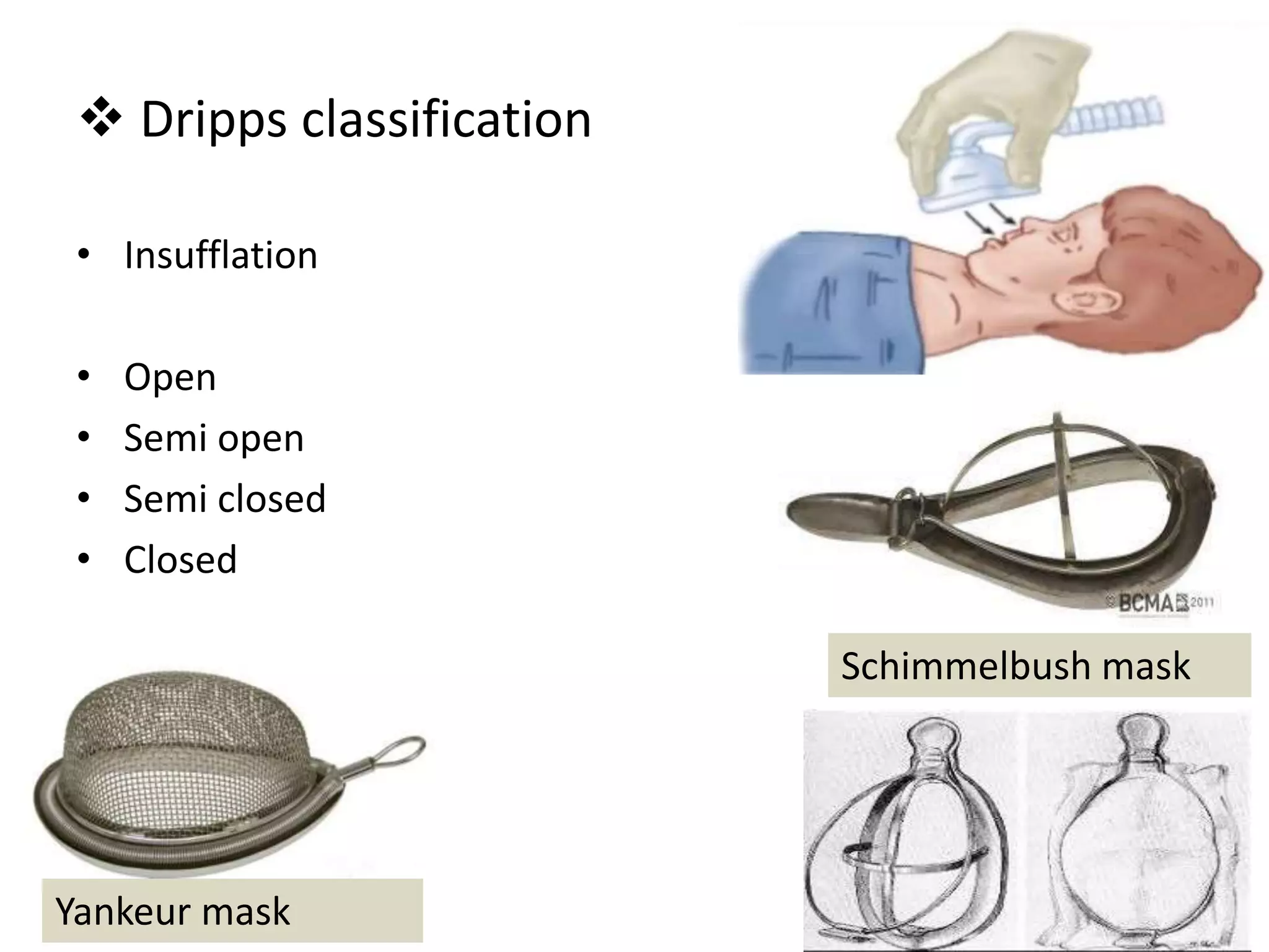  Dripps classification
• Insufflation
• Open
• Semi open
• Semi closed
• Closed
Schimmelbush mask
Yankeur mask
 