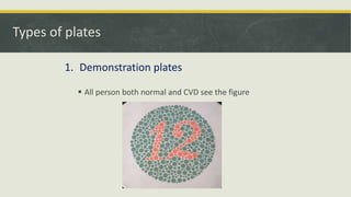 Color vision : Physiology ,Defects, Detection, Diagnosis & Management ...