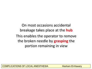 COMPLICATIONS OF LOCAL ANESTHESIA Hesham El-Hawary
	
  On	
  most	
  occasions	
  accidental	
  
breakage	
  takes	
  plac...
