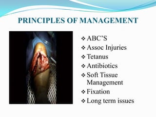Compound Fracture Tibia | PPTX