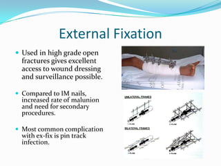Compound Fracture Tibia | PPTX