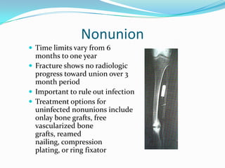 Nonunion
 Time limits vary from 6
  months to one year
 Fracture shows no radiologic
  progress toward union over 3
  month period
 Important to rule out infection
 Treatment options for
  uninfected nonunions include
  onlay bone grafts, free
  vascularized bone
  grafts, reamed
  nailing, compression
  plating, or ring fixator
 