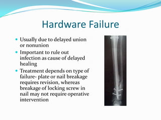 Hardware Failure
 Usually due to delayed union
  or nonunion
 Important to rule out
  infection as cause of delayed
  healing
 Treatment depends on type of
  failure- plate or nail breakage
  requires revision, whereas
  breakage of locking screw in
  nail may not require operative
  intervention
 