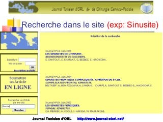 Recherche dans le site (exp: Sinusite)
Journal Tunisien d'ORL http://www.journal-storl.net/
 