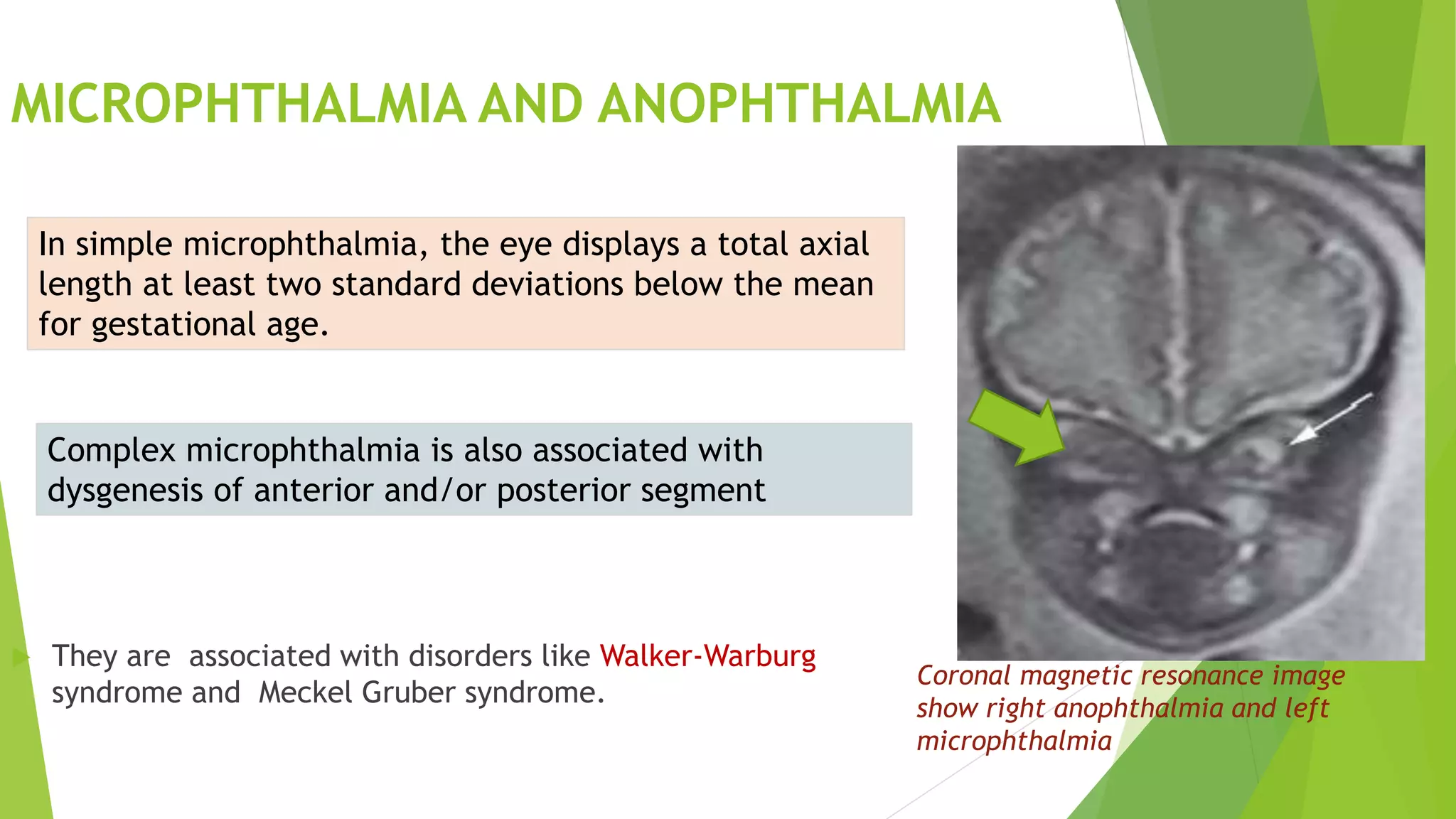 Congenital anomalies of head,neck and face(Radiology) including USG and ...