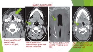 Congenital anomalies of head,neck and face(Radiology) including USG and ...