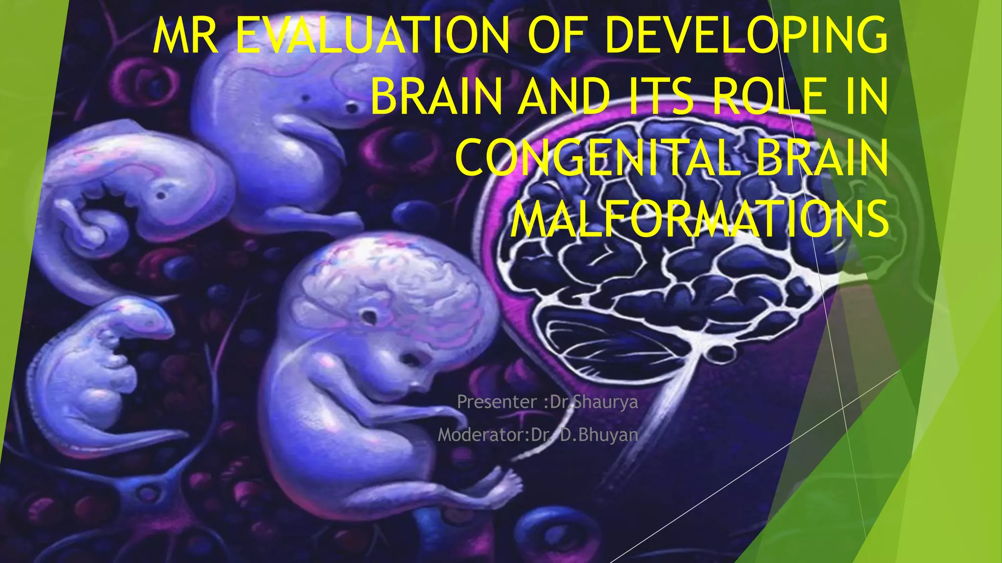 MRI evaluation of developing brain and its role in congenital brain
