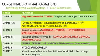 MRI evaluation of developing brain and its role in congenital brain ...