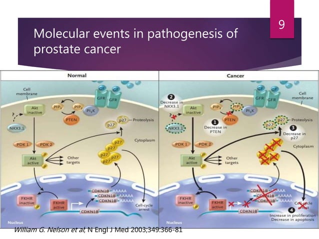 Metastatic Castration Resistant Prostate Cancer(mCRPC) | PPTX ...
