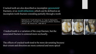 Infraction Tooth Cracks in Endodontics | PPTX