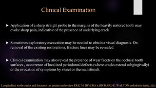 Sharp Linear Defect Tooth Cracks in Endodontics | PPTX