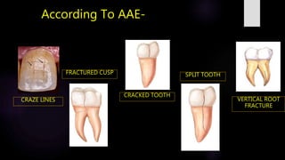 Cracks in Endodontics | PPTX