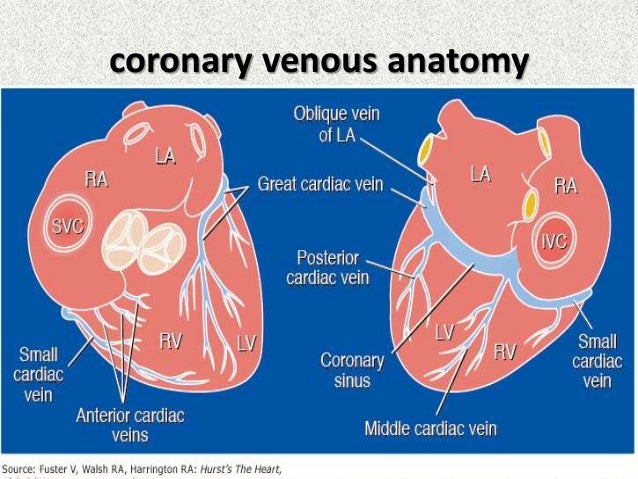 images Coronary Sinus Labeled coronary sinus