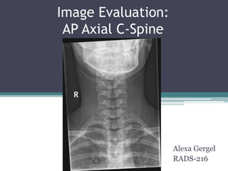 Image Evaluation:
AP Axial C-Spine
Alexa Gergel
RADS-216
 