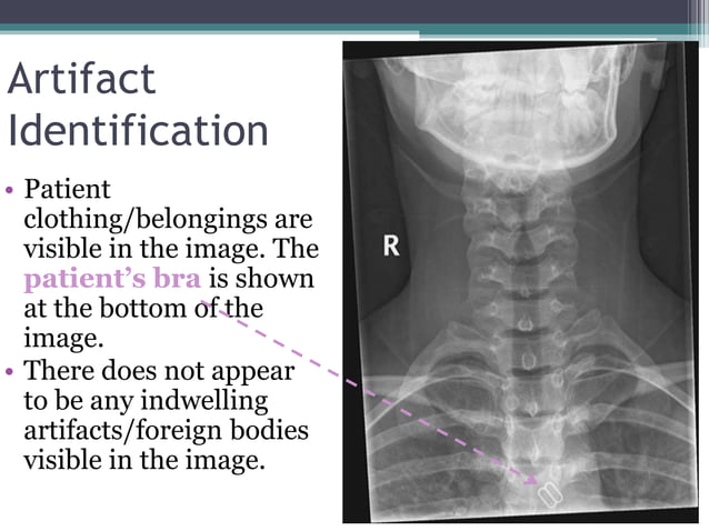 Image Evaluation: AP Axial C-Spine | PPTX