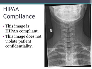 Image Evaluation: AP Axial C-Spine | PPTX