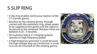 Ct Machine Rotation Ct working principle and artifacs in detailed manner | PPTX
