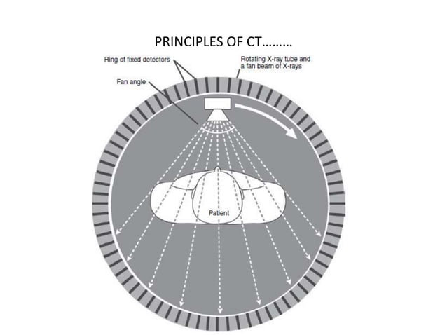 Ct Head Tutorial BASICS of CT Head | PPTX
