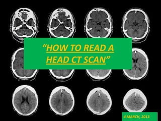 “HOW TO READ A
 HEAD CT SCAN”




                 4 MARCH, 2013
 
