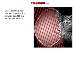 BASICS….
• X-RAYS ARE ABSORBED TO DIFFERENT DEGREES BY
  DIFFERENT TISSUES

• Always describe CT findings as densities-
  ...