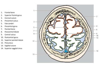 2 Frontal sinus
5 Falx cerebri
6 Caudate nucleus (head)
9 Corpus callosum (genu)
11 Lateral ventricle
12 Third ventricle
1...