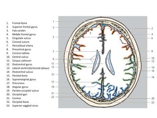 BASICS of CT Head