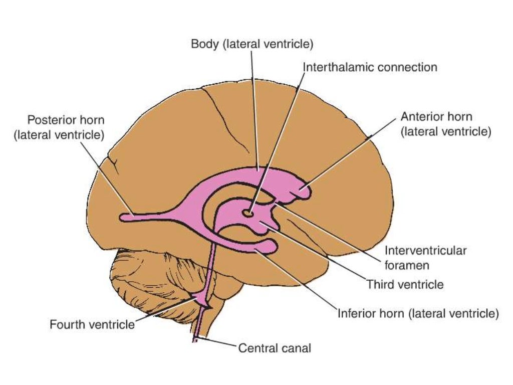 BASICS of CT Head