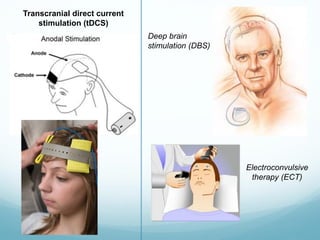 tDCS for consumers
 