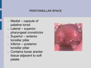 PERITONSILLAR SPACE
● Medial – capsule of
palatine tonsil
● Lateral – superior
pharyngeal cronstrictor
● Superior – anterior
tonsillar pillar
● Inferior – posterior
tonsillar pillar
● Contains loose areolar
tissue adjacent to soft
palate
 