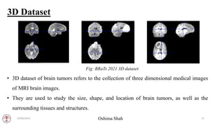 Final Defense ppt (brats)of brain tumor segmentation.pptx