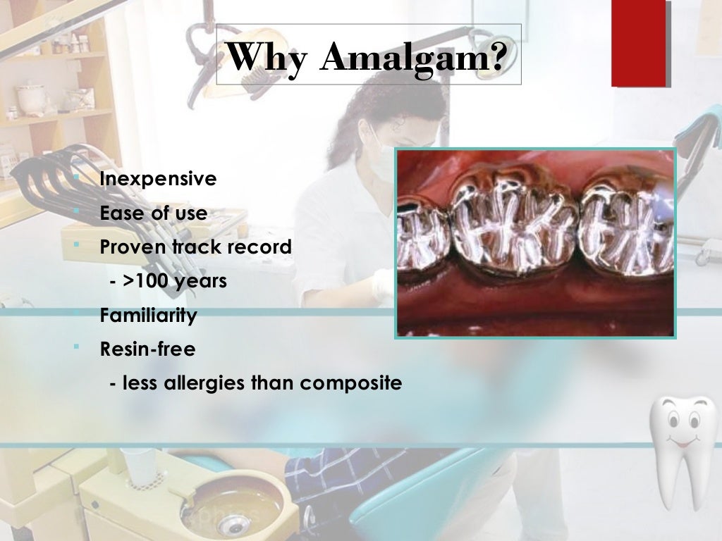 dental amalgam presentation