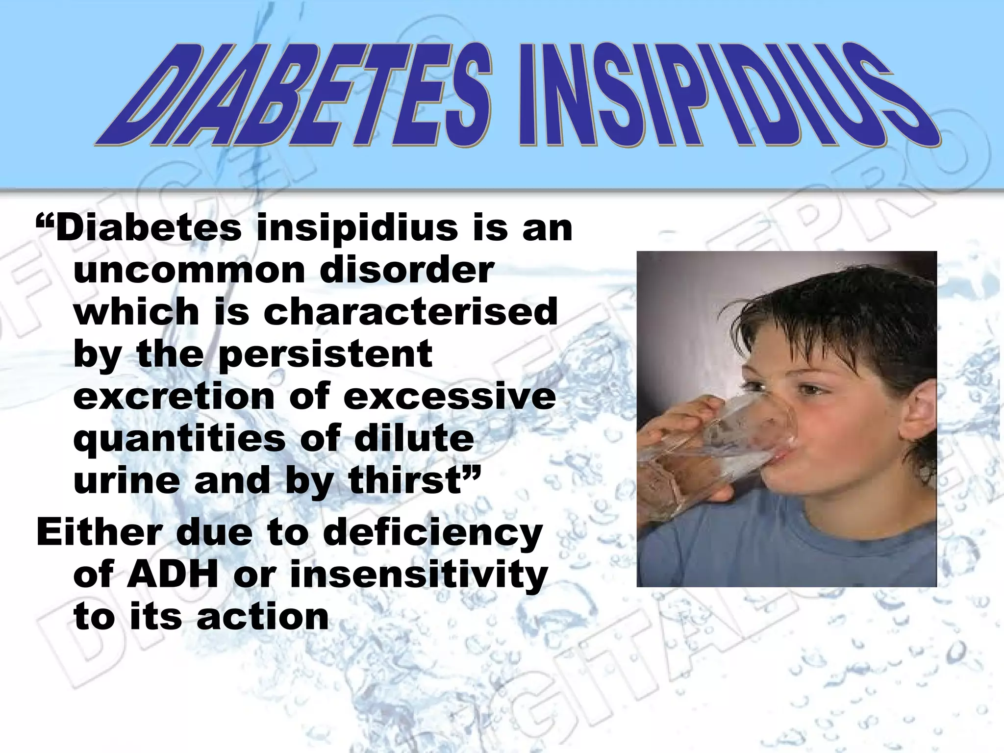 Diabetes Insipidus | PPT