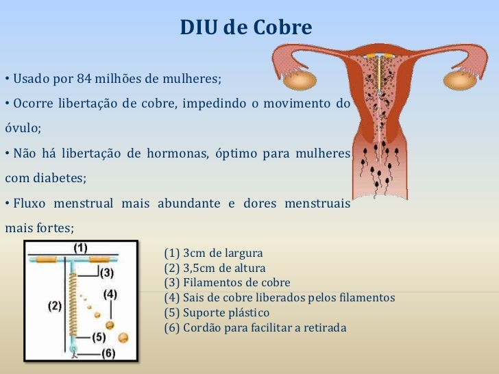 Quanto Tempo Depois De Colocar O Diu Pode Ter Relação