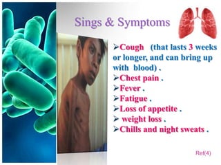 Sings & Symptoms
      Cough (that lasts 3 weeks
      or longer, and can bring up
      with blood) .
      Chest pain .
      Fever .
      Fatigue .
      Loss of appetite .
       weight loss .
      Chills and night sweats .

                           Ref(4)
 