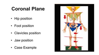 Coronal Plane
• Hip position
• Foot position
• Clavicles position
• Jaw position
• Case Example
 