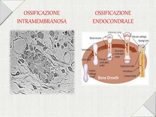 OSSIFICAZIONE
INTRAMEMBRANOSA
OSSIFICAZIONE
ENDOCONDRALE
 
