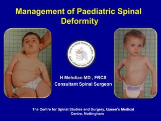 H Mehdian MD , FRCS
Consultant Spinal Surgeon
The Centre for Spinal Studies and Surgery, Queen’s Medical
Centre, Nottingham
Management of Paediatric Spinal
Deformity
 