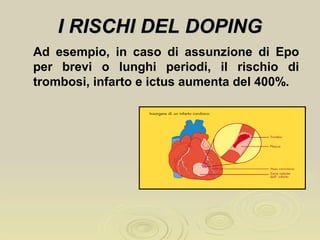 I RISCHI DEL DOPINGI RISCHI DEL DOPING
Ad esempio, in caso di assunzione di Epo
per brevi o lunghi periodi, il rischio di
trombosi, infarto e ictus aumenta del 400%.
 