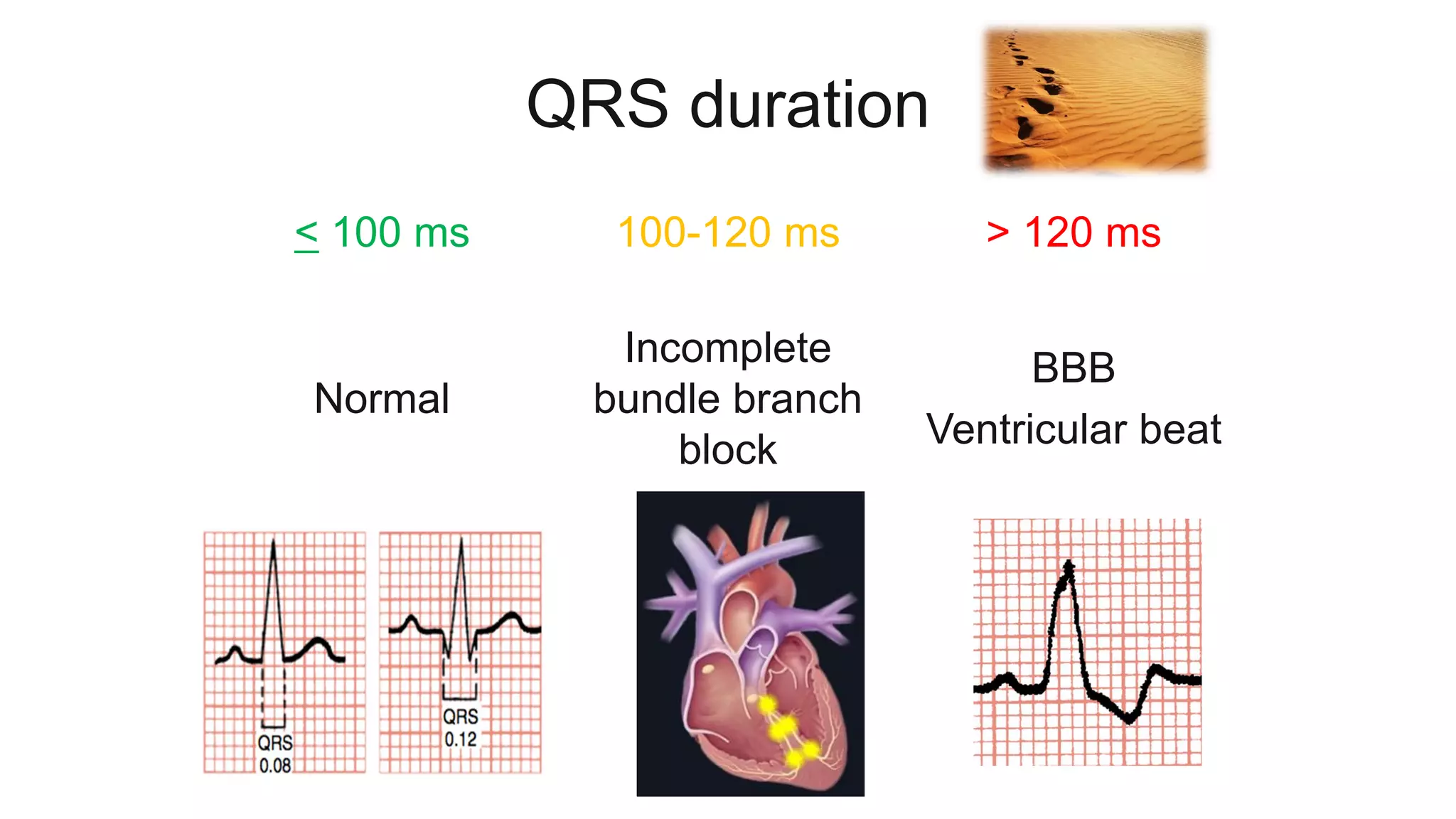 ECG made easy | PDF