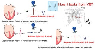Depolarization Vector of ventricles towards electrode
Depolarization Vector of septum away from electrode
Positive deflection (R wave)
1st negative deflection (Q wave)
3
Depolarization Vector of the base of heart away from electrode
Negative deflection after R (S wave)
How it looks from V6?
 