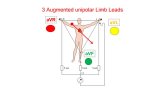 3 Augmented unipolar Limb Leads
aVR
aVL
aVF
 