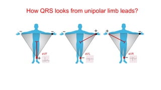 How QRS looks from unipolar limb leads?
 