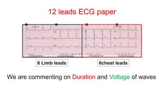 12 leads ECG paper
6 Limb leads 6chest leads
We are commenting on Duration and Voltage of waves
 
