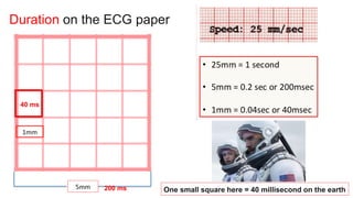 Duration on the ECG paper
40 ms
200 ms One small square here = 40 millisecond on the earth
 