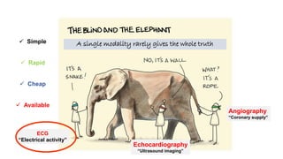 ECG
“Electrical activity”
Echocardiography
“Ultrasound imaging”
Angiography
“Coronary supply”
A single modality rarely gives the whole truth
 Simple
 Rapid
 Cheap
 Available
 
