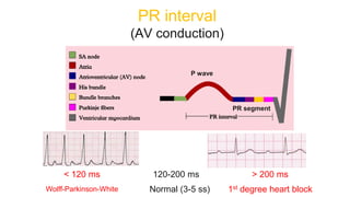 PR interval
(AV conduction)
PR segment
P wave
< 120 ms 120-200 ms > 200 ms
Wolff-Parkinson-White Normal (3-5 ss) 1st degree heart block
 